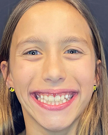 Patient at Orthodontist in Coralville and Iowa City IA