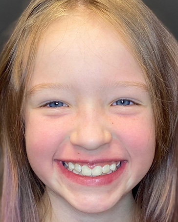 Patient at Pediatric Orthodontist in North Liberty IA