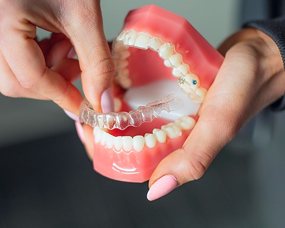 Invisalign Dentist Cedar Rapids Ia