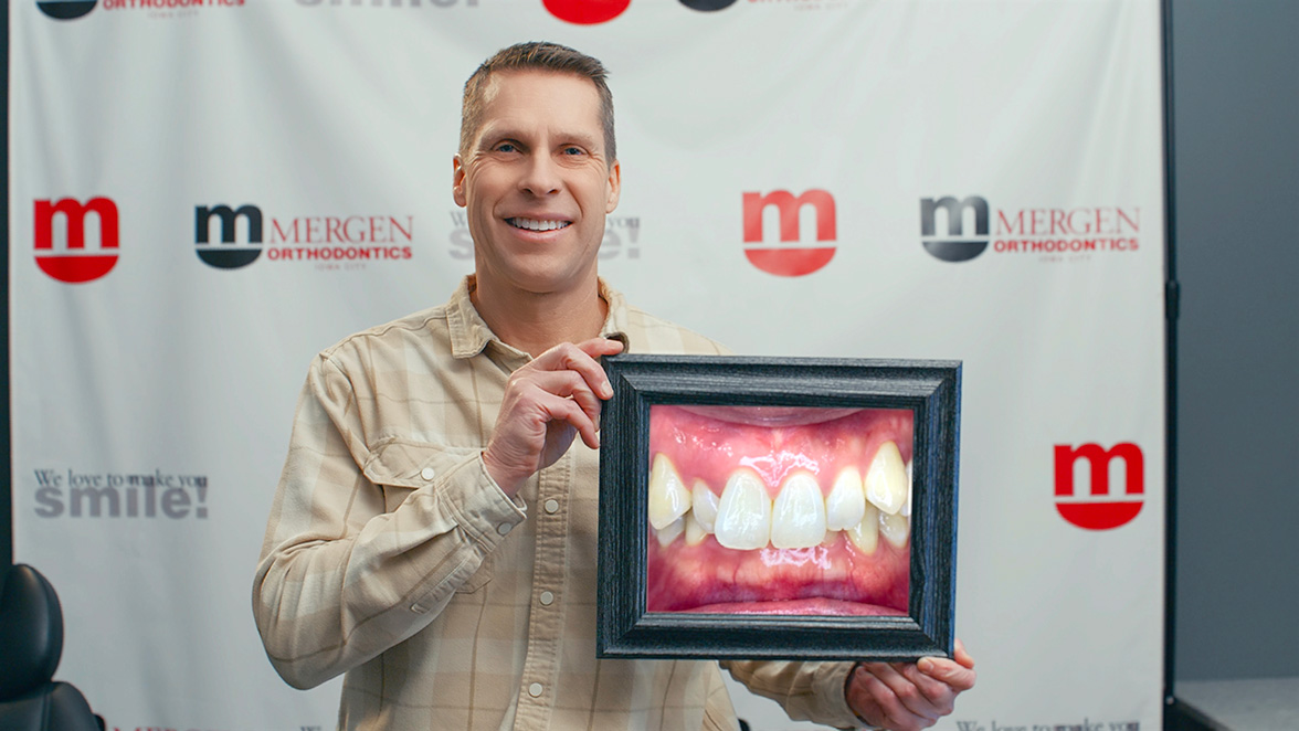 Coralville Iowa City Ia Invisalign Orthodontist